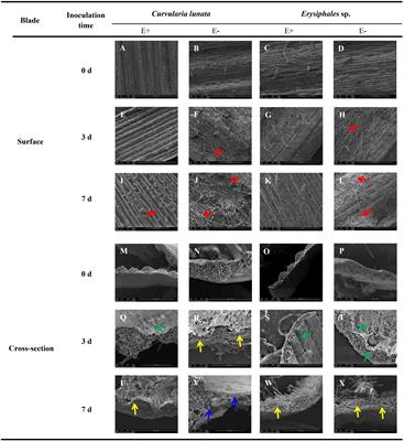 Endophytic Fungi Activated Similar Defense Strategies of Achnatherum sibiricum Host to Different Trophic Types of Pathogens